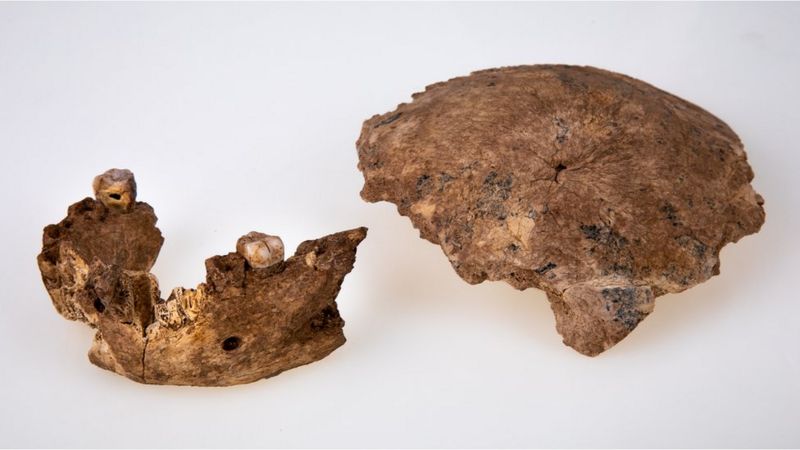 skullandjawbone.